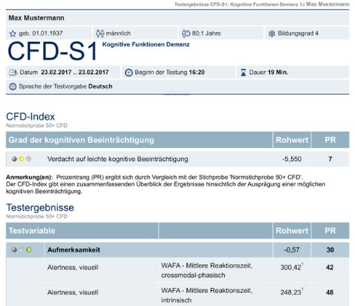 Bild von CFD-S1